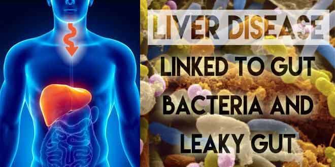 Featured visual summarizing evidence-based guidance related to Gut Bacteria Linked to Liver Disease.