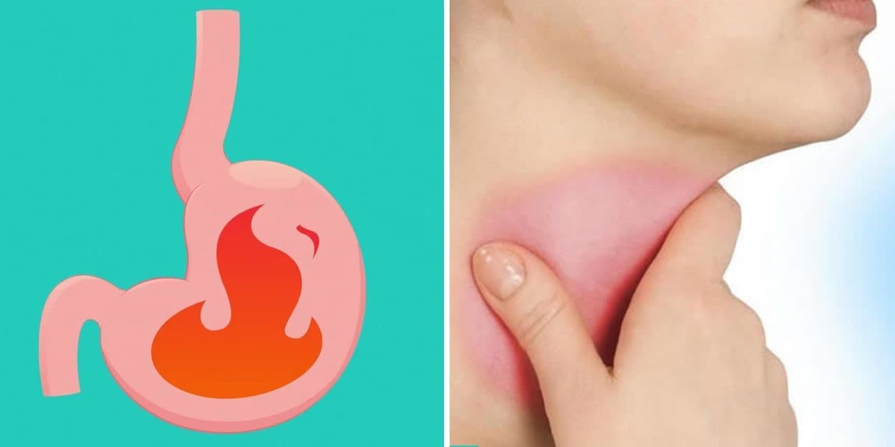 Featured visual summarizing evidence-based guidance related to Silent Acid Reflux: Manifestation, Treatment and Latest Research.