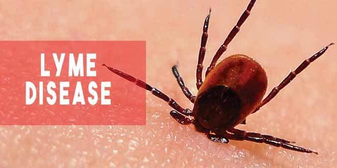 Lyme Disease Facts and Symptoms | How to Spot the Signs - Health
