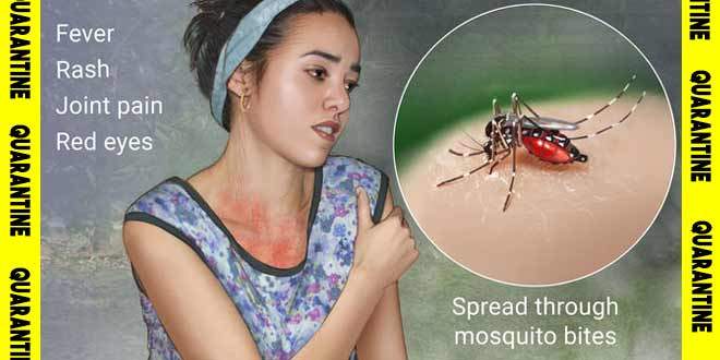 zika_visrus_660x330px