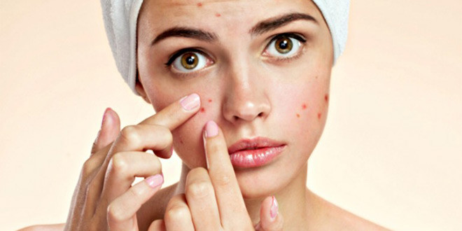 acne_660x330